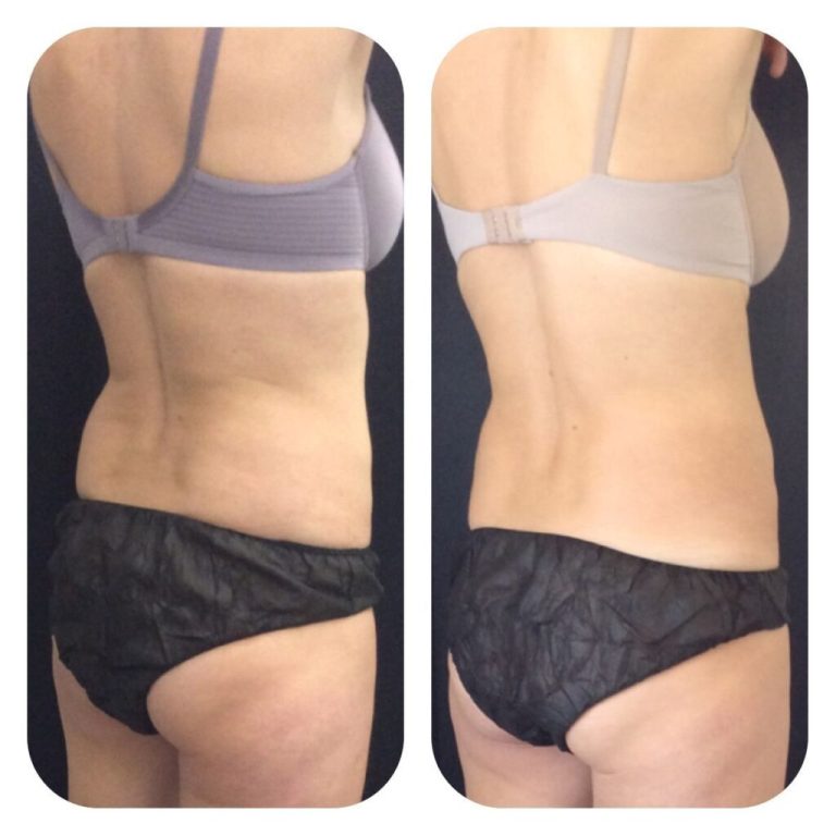 cool before and after