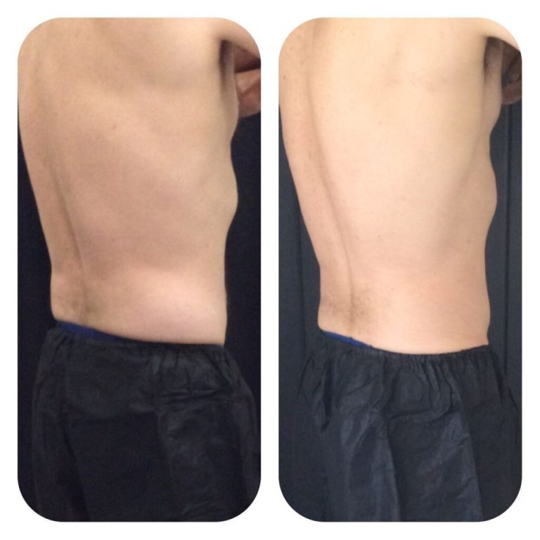 cool before and after