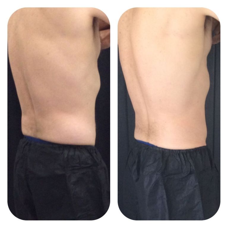 cool before and after